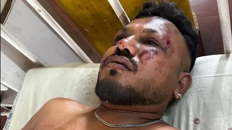 NO IDEA OF I SURVIVED AIR INDIA CRASH - SOLE SURVIVOR OF AIRCRAFT CARRYING 242 PASSENGERS